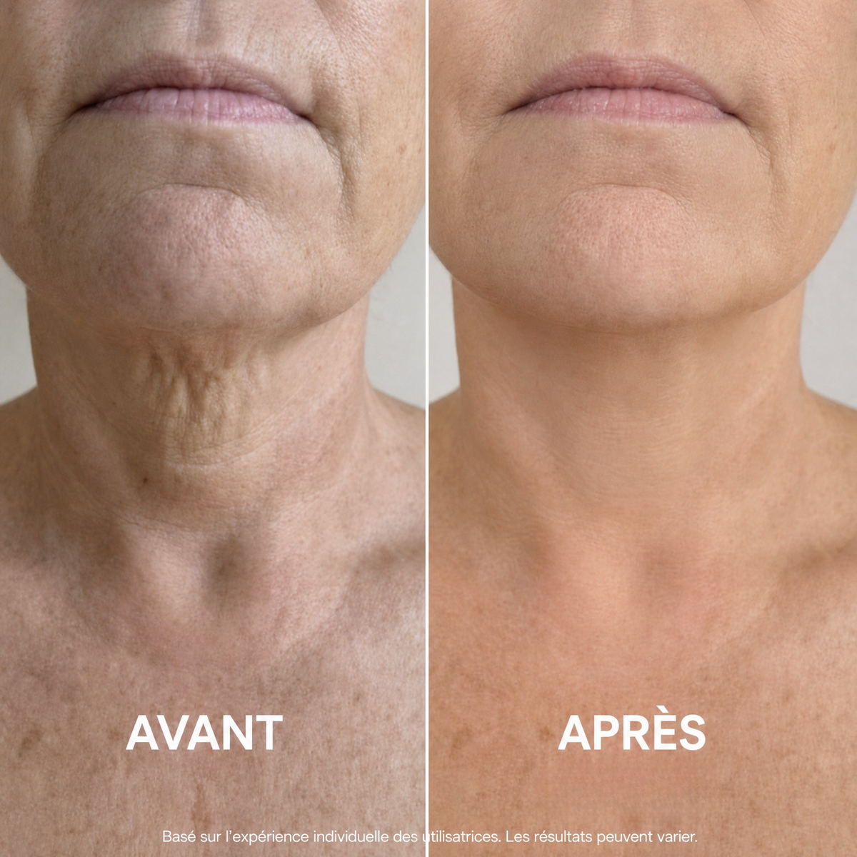Ondéa® Crème Cou Raffermissante — visuel 2