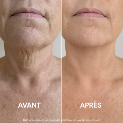 Ondéa® Crème Cou Raffermissante — visuel 2