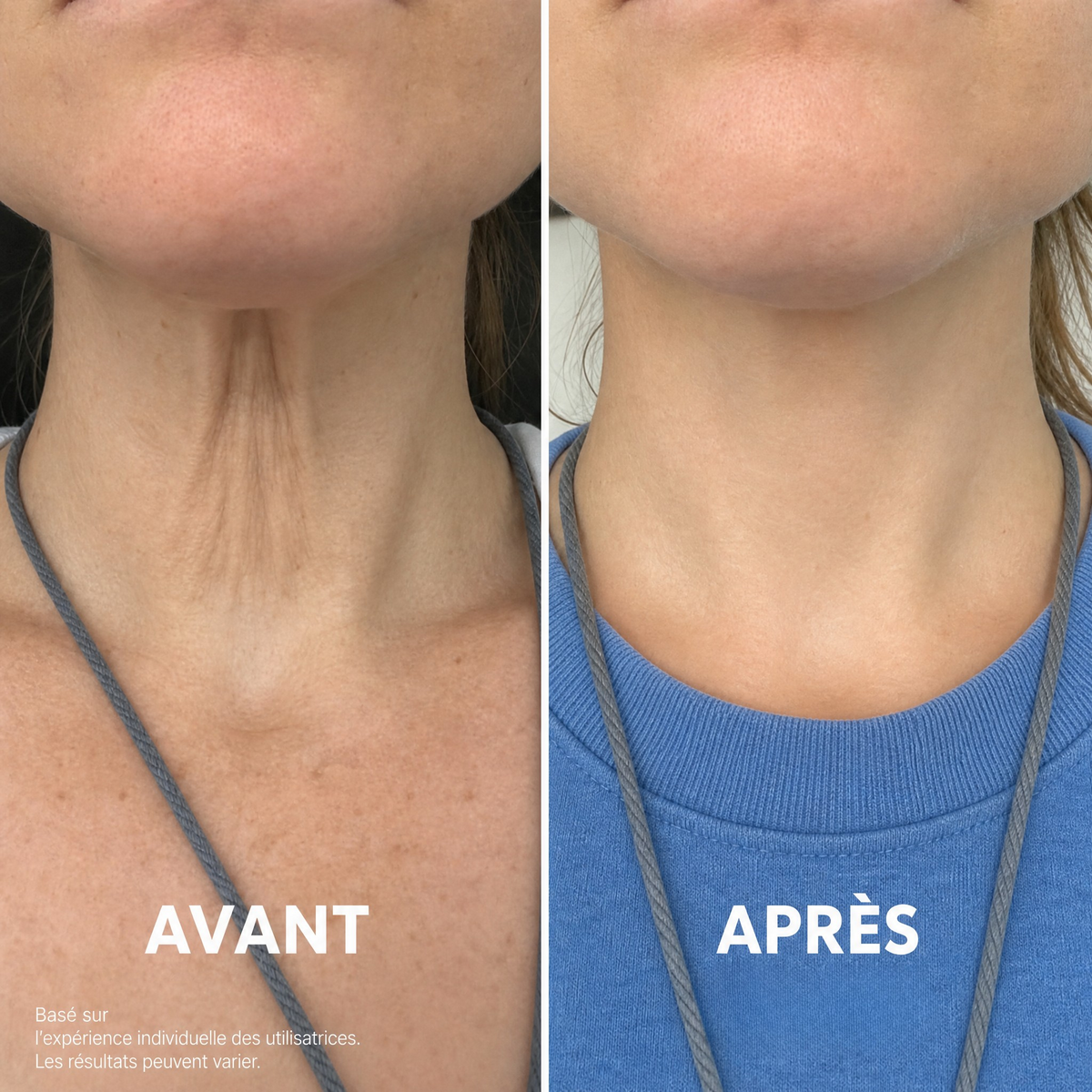 Ondéa® Crème Cou Raffermissante — visuel 4