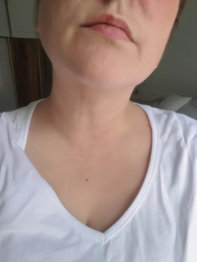 Après